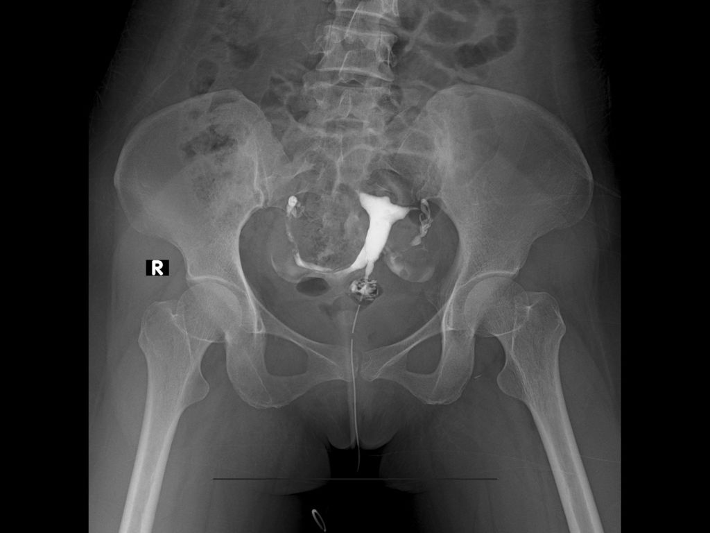ENSOCARE PUNE Center OPG  Digital X Ray
